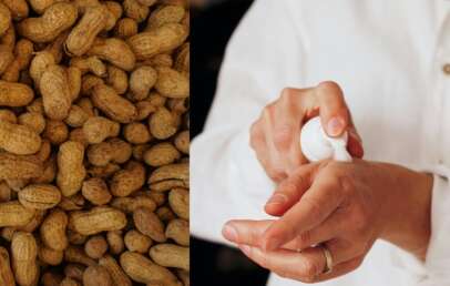 A collage of someone using lotion and a close-up image of peanuts.