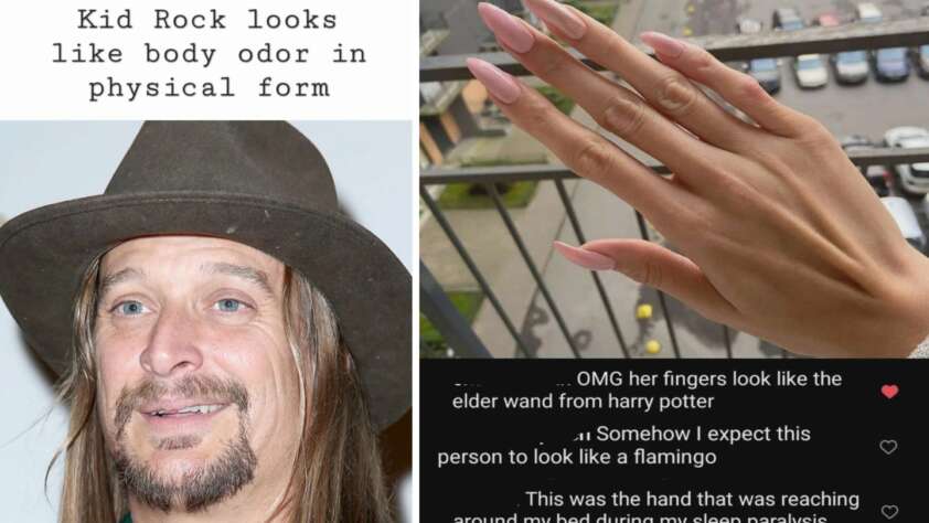 A split image: on the left is a person with long hair and a hat, with overlaid text saying "Kid Rock looks like body odor in physical form". On the right is a close-up of long pink nails on a hand, with comments describing the fingers as wizard-like and flamingo-like.