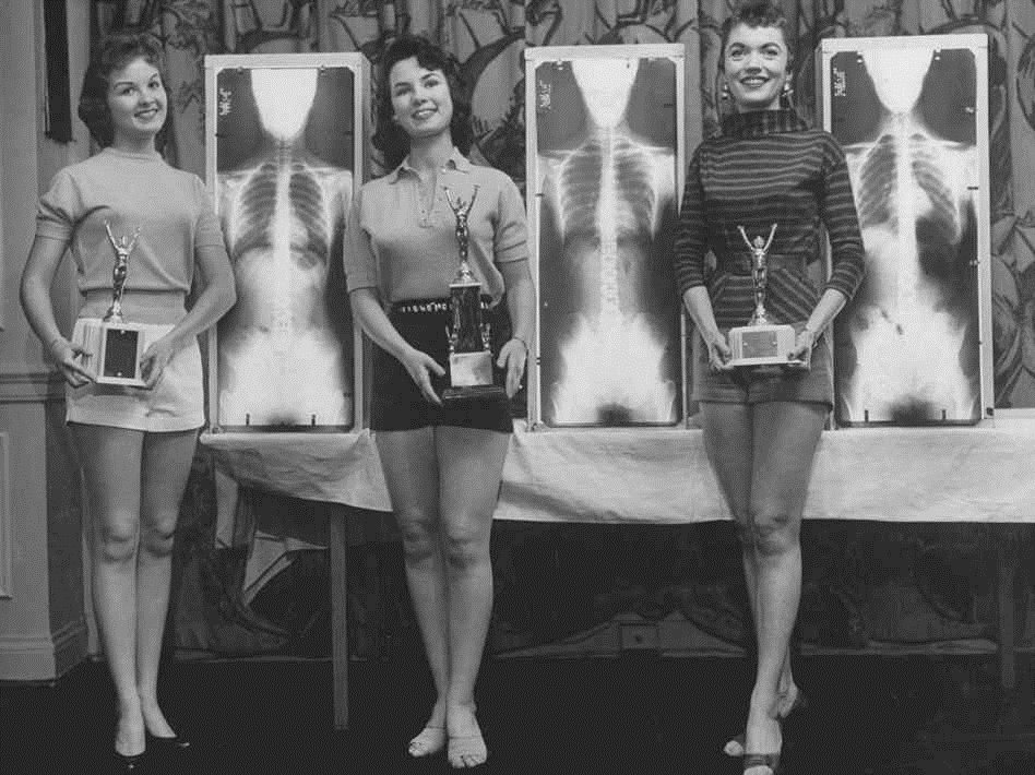 Three women standing in front of X-ray images of their torsos, each holding a trophy and smiling. The women are wearing shorts and tops. The background includes a patterned curtain or wall covering. The scene appears to be a part of a health or beauty contest.