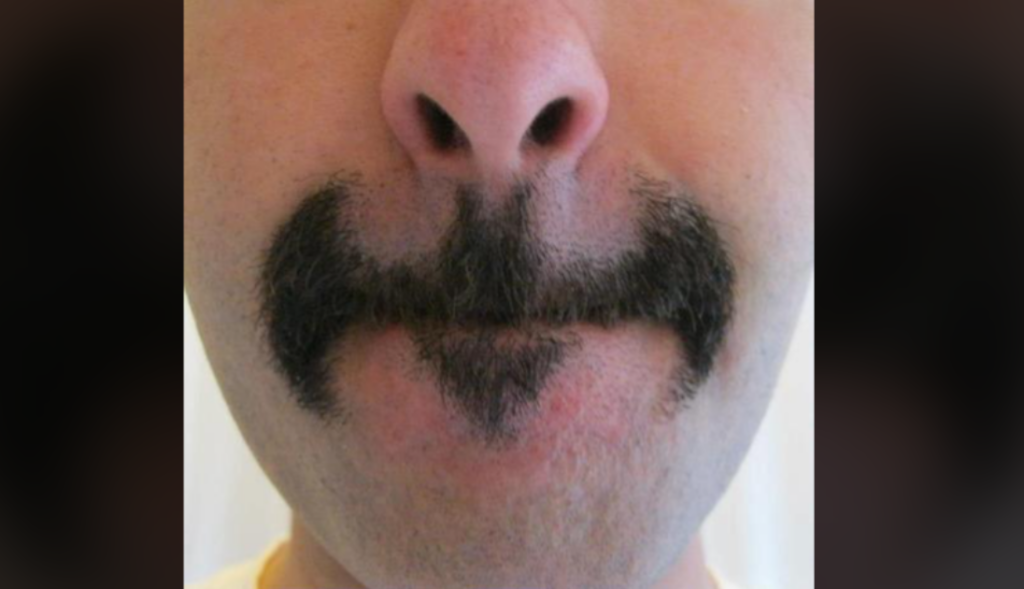 Close-up of a person's unique mustache, styled in an unusual pattern with a thick section on each side of the upper lip and a small triangle shape just below the center of the lower lip. The upper lip area above the mustache is shaved clean.