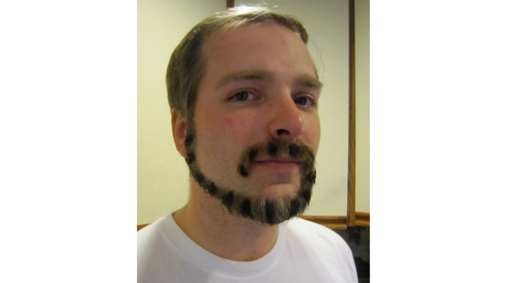 A man with short hair and a unique beard style featuring disconnected patches of facial hair. The beard includes a patch on the chin, and striking patches on the sideburns and upper lip area. He is wearing a white shirt and standing indoors.