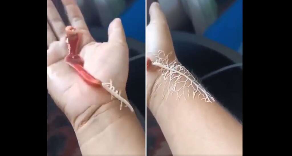 This image shows two close-up views of a hand with a peculiar object emerging from it. On the left, a red, fleshy, branching structure is seen hanging from the palm. On the right, a similar but white, vein-like structure appears to be extending from the wrist.