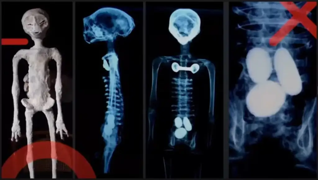 A collage featuring four images of a skeletal figure. Two are full-body x-rays, one is a side view, and one is a frontal view. Another image shows internal structures highlighted in white against a dark background.