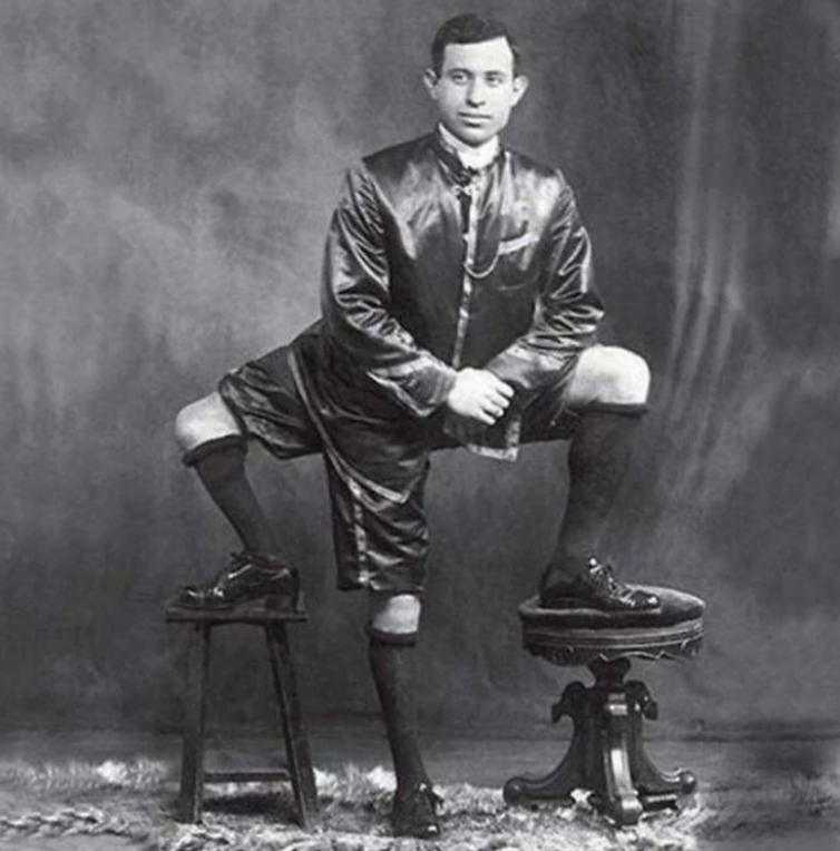 A man with prosthetic legs sits on a stool, wearing a satin suit. He has one leg resting on a second stool. The background is a vintage studio setting, and the photo is black and white.